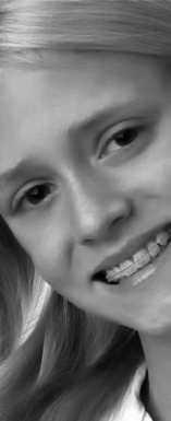 Perfect Smile Orthodontic smile